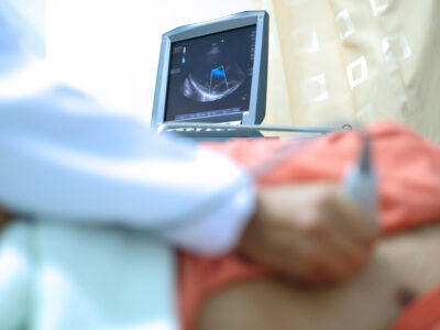 A doctor uses echocardiography to scan a patient's heart