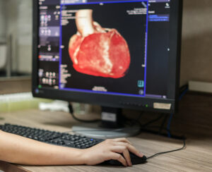 A doctor looks at a heart scan on a computer.