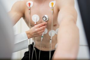 Close up of a man's chest with heart monitors attached before he undergoes a cardiac stress test
