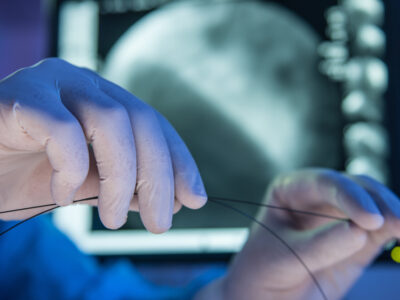 Close up of doctor's hands holding a heart stent