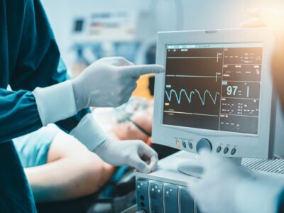 Doctor points at an electrocardiogram on a computer monitor