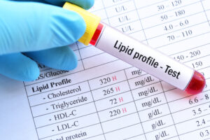 Lipid test tube and results close up