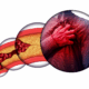 Animated view with 3 circular portraits of a clogged artery leading to a man gripping his chest with heart pain or failure.